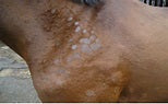 Equine Ringworm - a contagious skin condition humans can catch.